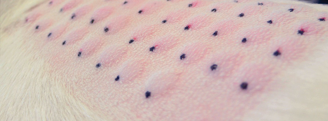 hdr-image-dermatology